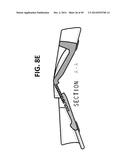 INCREMENTAL AND/OR SUCCESSIVE ADJUSTABLE MANDIBULAR ADVANCEMENT DEVICE FOR     PREVENTING AND TREATMENT OF SNORING AND OBSTRUCTIVE SLEEP APNEA diagram and image