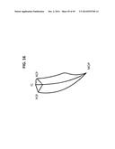 INCREMENTAL AND/OR SUCCESSIVE ADJUSTABLE MANDIBULAR ADVANCEMENT DEVICE FOR     PREVENTING AND TREATMENT OF SNORING AND OBSTRUCTIVE SLEEP APNEA diagram and image