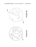 SYSTEM AND METHOD FOR DENSE-STOCHASTIC-SAMPLING IMAGING diagram and image