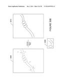 SYSTEM AND METHOD FOR DENSE-STOCHASTIC-SAMPLING IMAGING diagram and image