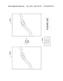 SYSTEM AND METHOD FOR DENSE-STOCHASTIC-SAMPLING IMAGING diagram and image