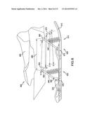 REMOTELY ADJUSTABLE SUSPENSION COUPLING diagram and image