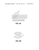 ULTRASOUND IMAGE ENHANCEMENT AND SUPER-RESOLUTION diagram and image