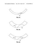 Methods of Predicting Musculoskeletal Disease diagram and image