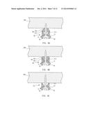 FASTENING DEVICE diagram and image