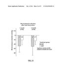 Methods for Therapeutic Renal Denervation diagram and image