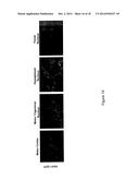 GENE THERAPY FOR SPINAL CORD DISORDERS diagram and image