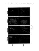 GENE THERAPY FOR SPINAL CORD DISORDERS diagram and image