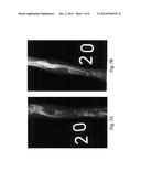 BMP-1 Procollagen C-Proteinase for Diagnosis and Treatment of Bone and     Soft Tissue Defects and Disorders diagram and image