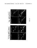 RETINOID-LIPOSOMES FOR TREATING FIBROSIS diagram and image