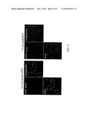 RETINOID-LIPOSOMES FOR TREATING FIBROSIS diagram and image