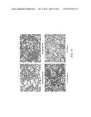 RETINOID-LIPOSOMES FOR TREATING FIBROSIS diagram and image