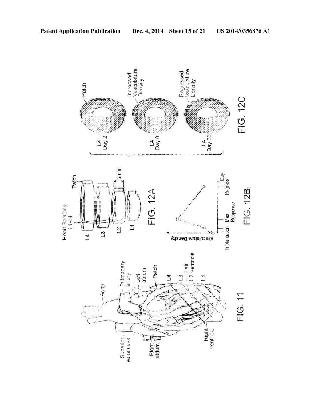 SYSTEMS AND METHODS FOR IMAGING AND PROCESSING TISSUE - diagram, schematic, and image 16
