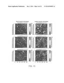 SYSTEMS AND METHODS FOR IMAGING AND PROCESSING TISSUE diagram and image