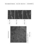 SYSTEMS AND METHODS FOR IMAGING AND PROCESSING TISSUE diagram and image