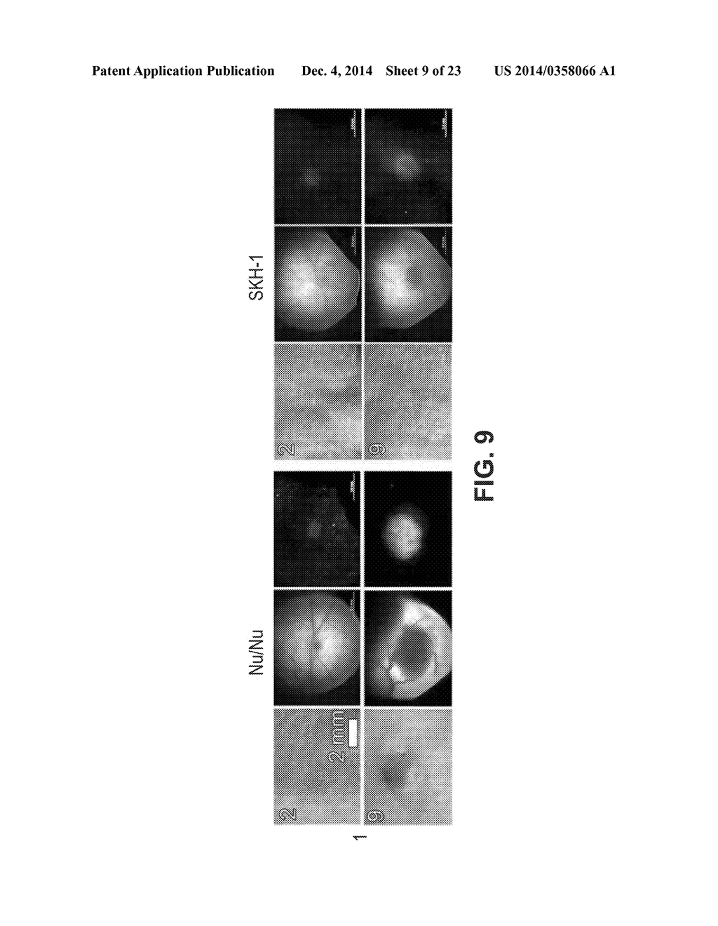 METHODS AND DEVICES FOR STIMULATING AN IMMUNE RESPONSE USING NANOSECOND     PULSED ELECTRIC FIELDS - diagram, schematic, and image 10