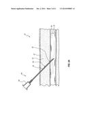 DEVICES FOR CREATION OF MULTIPLE VASCULAR ACCESS SITES diagram and image