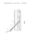 DEVICES FOR CREATION OF MULTIPLE VASCULAR ACCESS SITES diagram and image