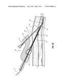 DEVICES FOR CREATION OF MULTIPLE VASCULAR ACCESS SITES diagram and image