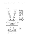 MEDICAL TUBE HARNESS diagram and image