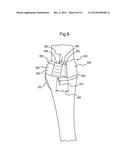 ABSORBENT ARTICLES AND METHODS OF MANUFACTURING THE SAME diagram and image