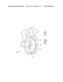 DEVICES AND METHODS FOR TREATING BONE TISSUE diagram and image