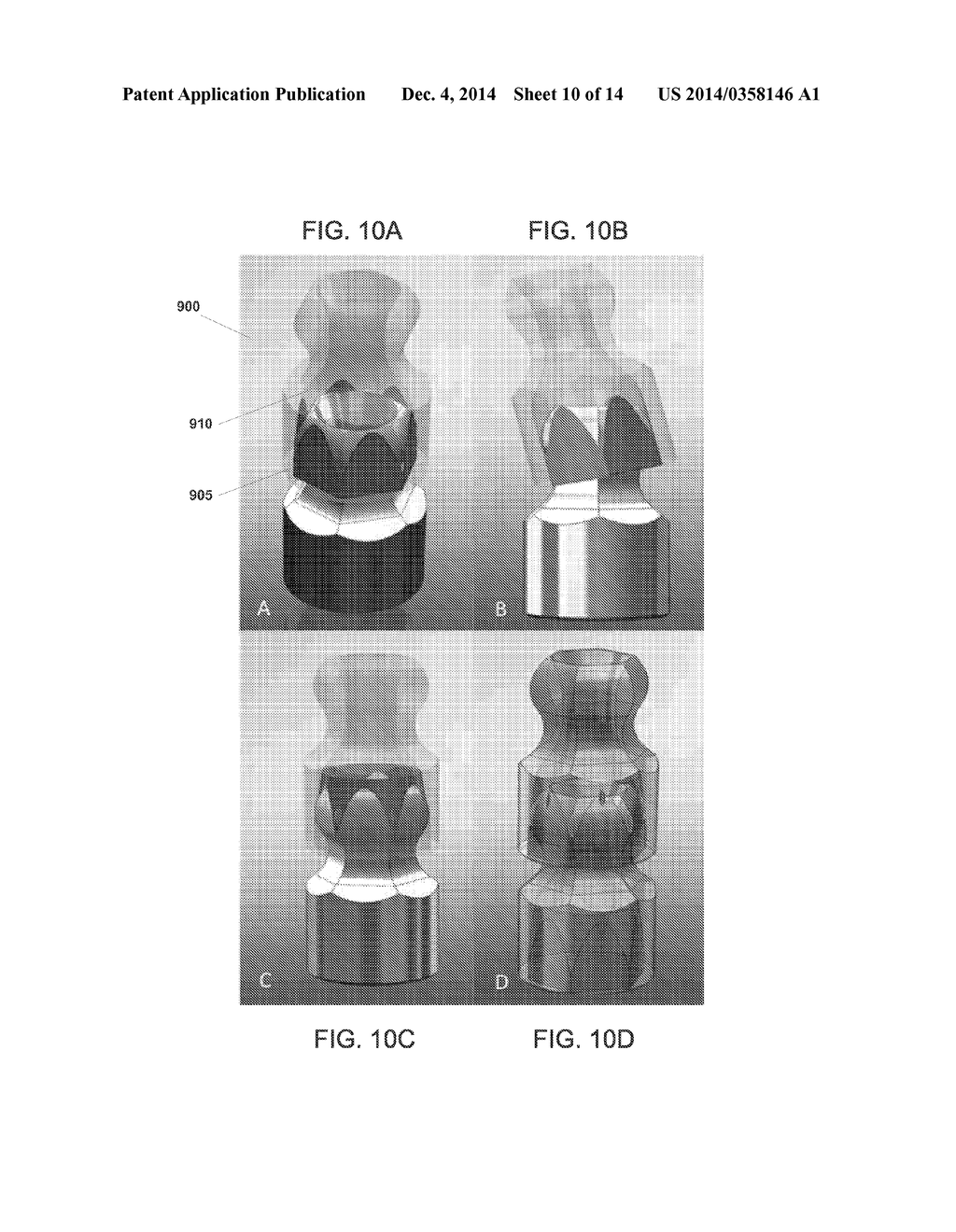 INTRAMEDULLARY FIXATION SYSTEM FOR MANAGEMENT OF PELVIC AND ACETABULAR     FRACTURES - diagram, schematic, and image 11