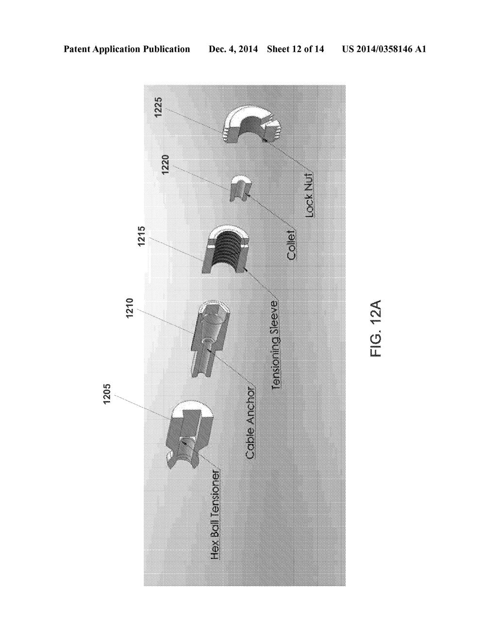 INTRAMEDULLARY FIXATION SYSTEM FOR MANAGEMENT OF PELVIC AND ACETABULAR     FRACTURES - diagram, schematic, and image 13