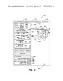 METHOD AND APPARATUS FOR PERFORMING ANTERIOR HIP SURGERY diagram and image