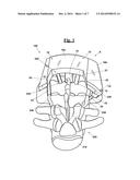 DRILLING MASK FOR IMPLANTING A TRANSPEDICULAR SCREW diagram and image