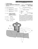 Tissue Suturing Device diagram and image