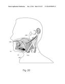 Device and Method for Snoring Detection and Control diagram and image