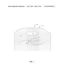 Implant Unit for Modulation of Small Diameter Nerves diagram and image