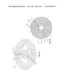 Implant Unit for Modulation of Small Diameter Nerves diagram and image