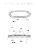 Implant Unit for Modulation of Small Diameter Nerves diagram and image