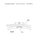 Implant Unit for Modulation of Small Diameter Nerves diagram and image