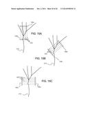 Implant Unit for Modulation of Small Diameter Nerves diagram and image