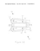 METHODS AND APPARATUS FOR AN OSTEOTOMY FIXATION OR ARTHRODESIS CAGE diagram and image