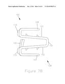 METHODS AND APPARATUS FOR AN OSTEOTOMY FIXATION OR ARTHRODESIS CAGE diagram and image