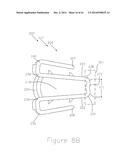 METHODS AND APPARATUS FOR AN OSTEOTOMY FIXATION OR ARTHRODESIS CAGE diagram and image