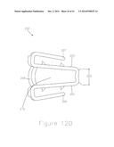 METHODS AND APPARATUS FOR AN OSTEOTOMY FIXATION OR ARTHRODESIS CAGE diagram and image