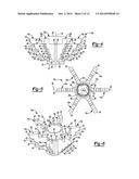 SHOULDER PROSTHESIS diagram and image