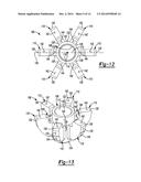 SHOULDER PROSTHESIS diagram and image