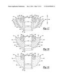 SHOULDER PROSTHESIS diagram and image