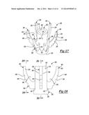 SHOULDER PROSTHESIS diagram and image