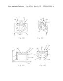 METHODS AND APPARATUS FOR A MULTIPLE TRANSITION TEMPERATURE IMPLANT diagram and image