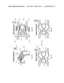 METHODS AND APPARATUS FOR A MULTIPLE TRANSITION TEMPERATURE IMPLANT diagram and image