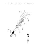 COMBINED LARYNGO-TRACHEAL ANESTHETIC AND STYLET DEVICE diagram and image