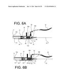 COMBINED LARYNGO-TRACHEAL ANESTHETIC AND STYLET DEVICE diagram and image