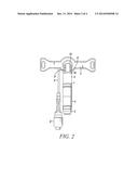 TRACHEOSTOMY TUBES diagram and image